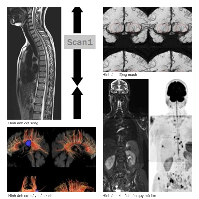 MAY_MRI_BV_VTTU_1-1